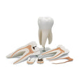 Giant Molar with Dental Cavities 15x Life Size R196845
