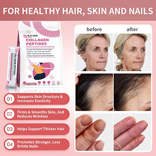 Multi Collagen Peptides Powder Type I II III V X Hydrolyzed Collagen Peptides with Prebiotics Sugar-Free Non-GMO Q7503
